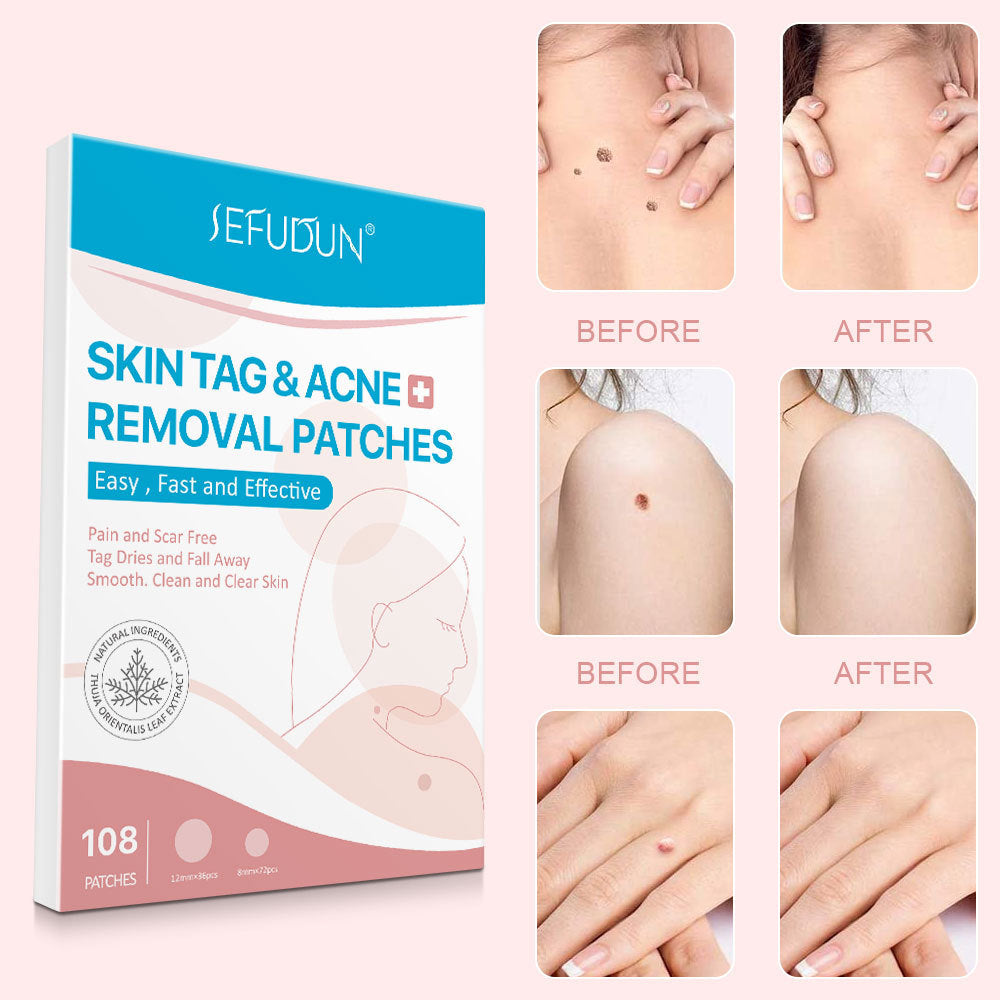Women Blackhead Patch