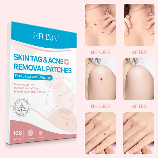 Women Blackhead Patch