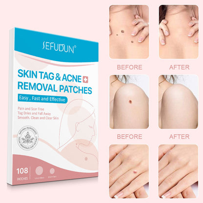Women Blackhead Patch